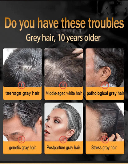Anti Gray Hair Serum Remedy White Darkening Products