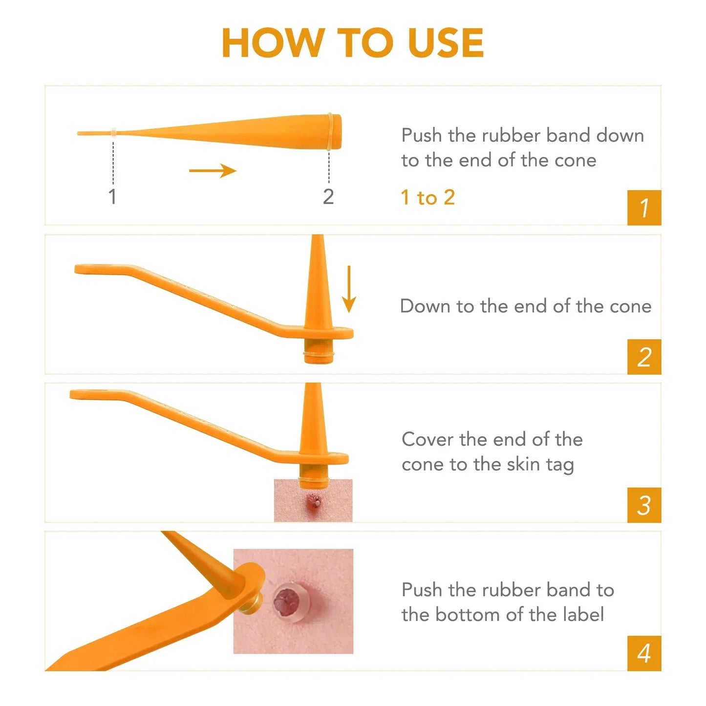 Simple Wart Removal Tool Set Skin Tag Removeal Tool Easy To Clean Skin Care Tool Skin Tag Removal Care Products