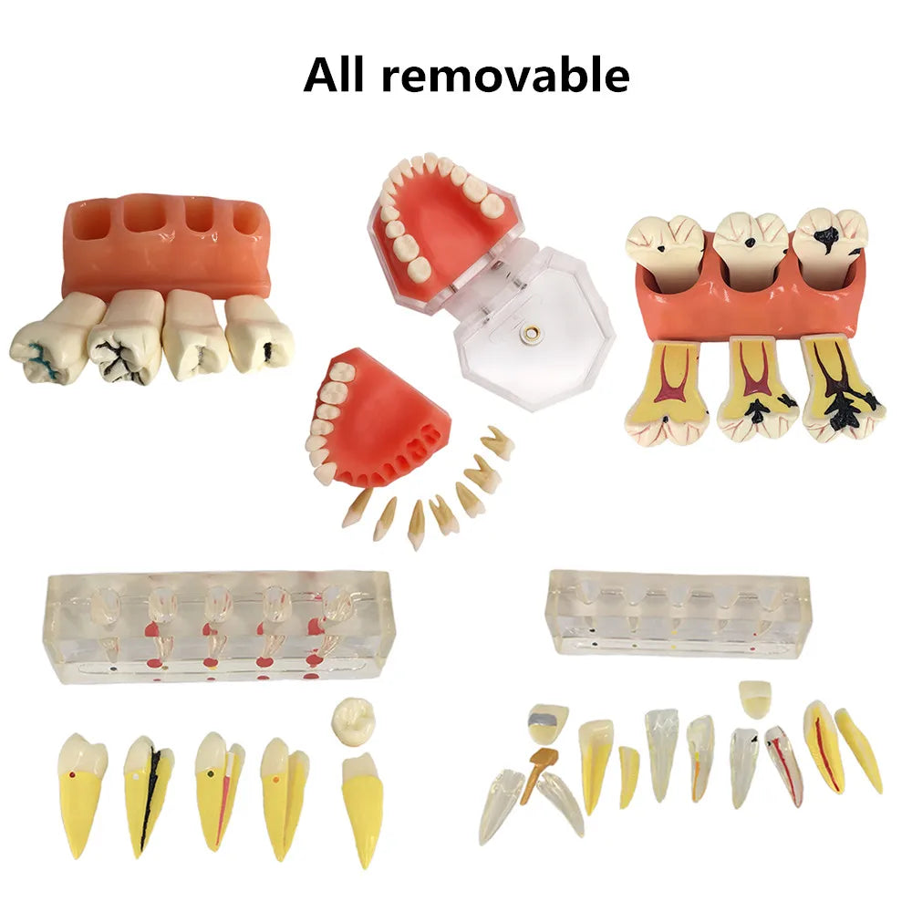 41 Styles Dental Model Teeth Teaching Model Dentist Typodont Orthodontic Jaw Model For Studying   Dentistry Products Accessories