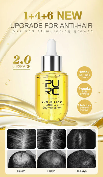 PURC Ginger Hair Serum for Men Women Scalp Treatment Repair Damaged Dry Moisturizing Hair Care Products 50ml