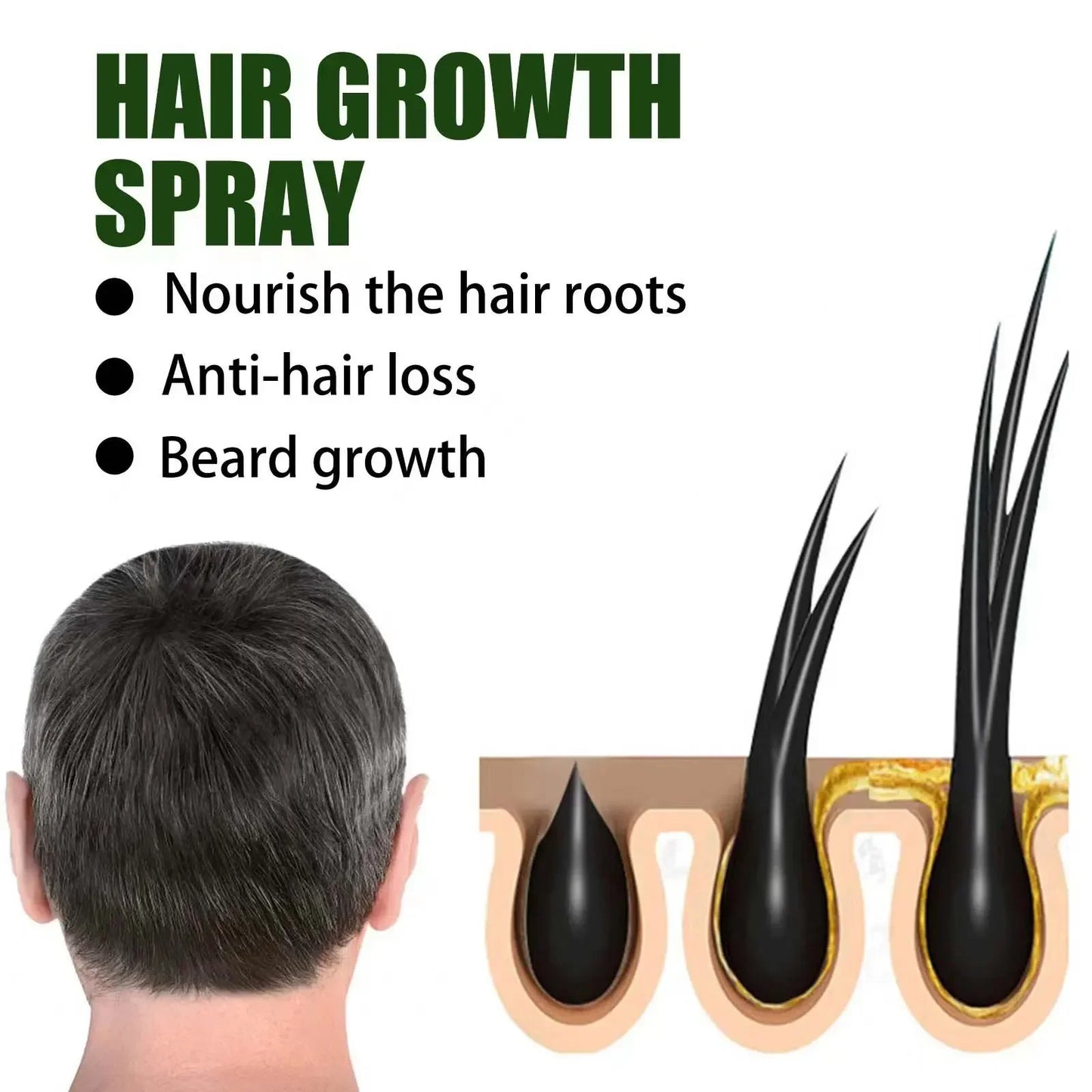 Hair Growth Oil Fast Growing Hair Effective Essential Baldness Repair Hereditary Anti Postpartum Seborrheic Hair Loss Products