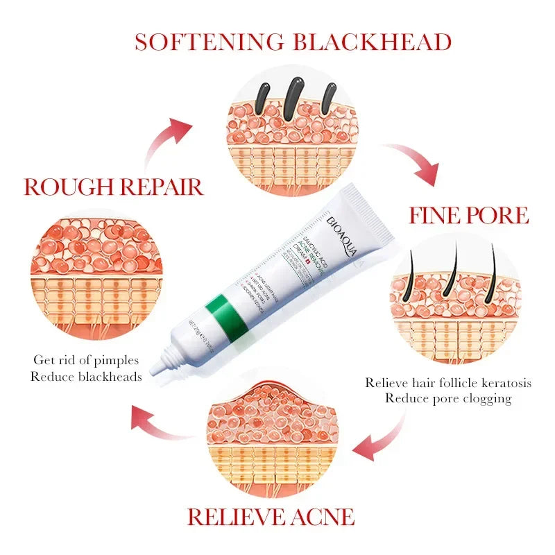 Salicylic Acid Face Cream Acne Creams Mark Repair Firming Moisturizing Blackhead Remover skincare Facial Cream
