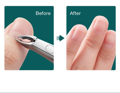 MR.GREEN Nail Cuticle Nipper Manicure Scissors Stainless Steel Dead Skin Remover Pusher Tool Trimmer