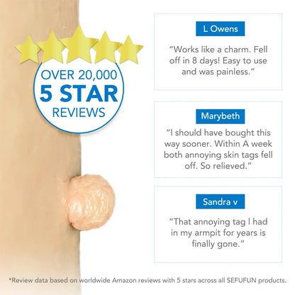 Simple Wart Removal Tool Set Skin Tag Removeal Tool Easy To Clean Skin Care Tool Skin Tag Removal Care Products