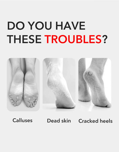 1Pcs Pedicure Tools Professional Foot Rasp Scrubber With Nail Clipper Double-Sided Dead Skin Remover File For Feet Care Spa Tool