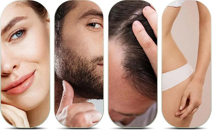 Titanium Alloy 540 Derma Roller Micro Needles Length Dermoroller Microniddle Roller for Face Skin Care Treatment Hair Growth