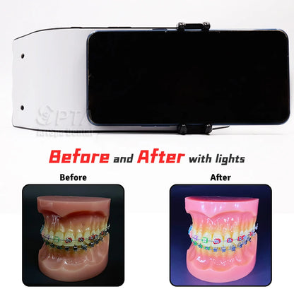 Flash Dental Photography Light Cutting Edge LED Lamp Designed Dentists Equipment Provides Optimal Lighting Oral Filling